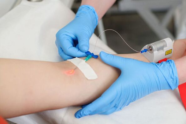 tratamento a laser intravenoso para psoríase nas pernas