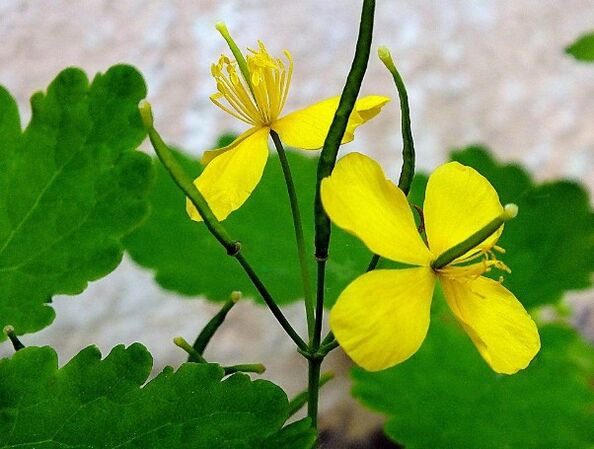 Celandine para o tratamento da psoríase